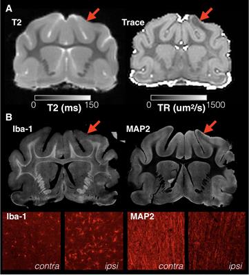 Frontiers | Detection And Distinction Of Mild Brain Injury Effects In A ...